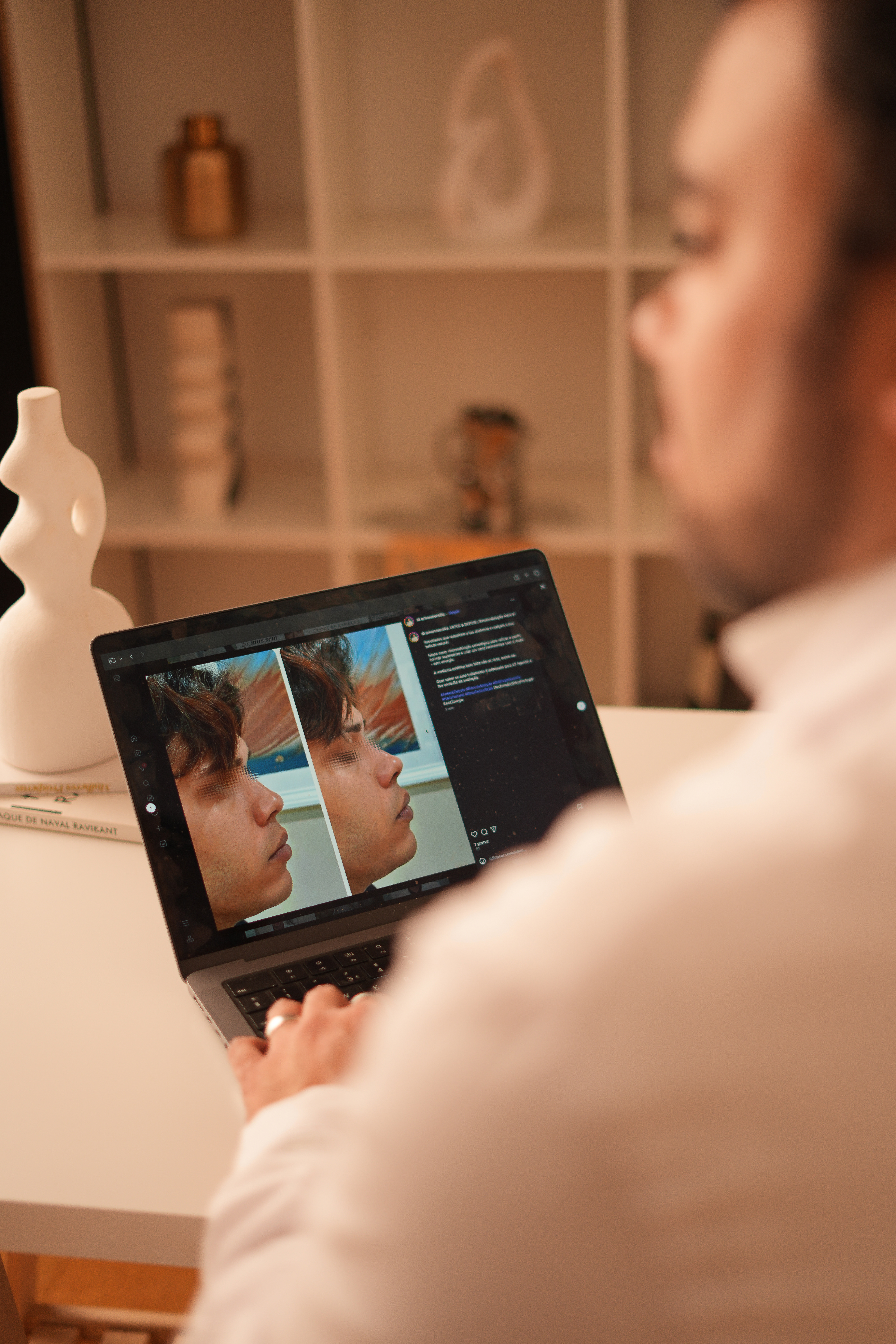 Tratamentos Estéticos